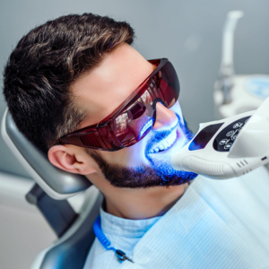 Blanqueamiento Dental en Cartagena: Recupera el brillo de tu Sonrisa