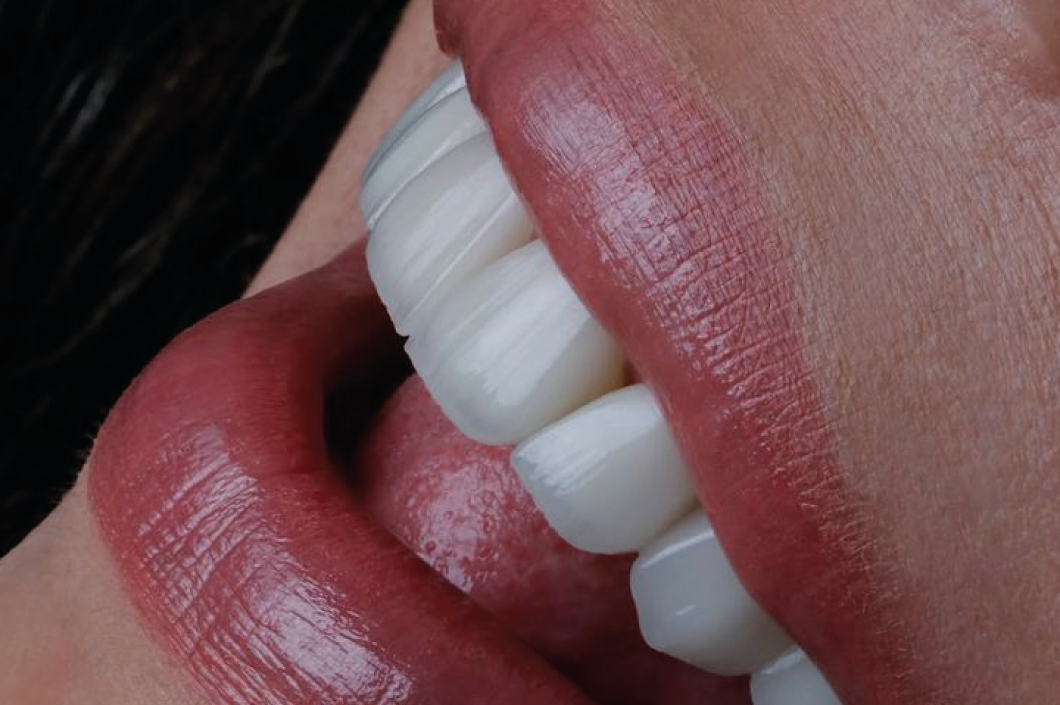 ¡Sonríe sin Complejos! Descubre el Poder del Diseño de Sonrisa