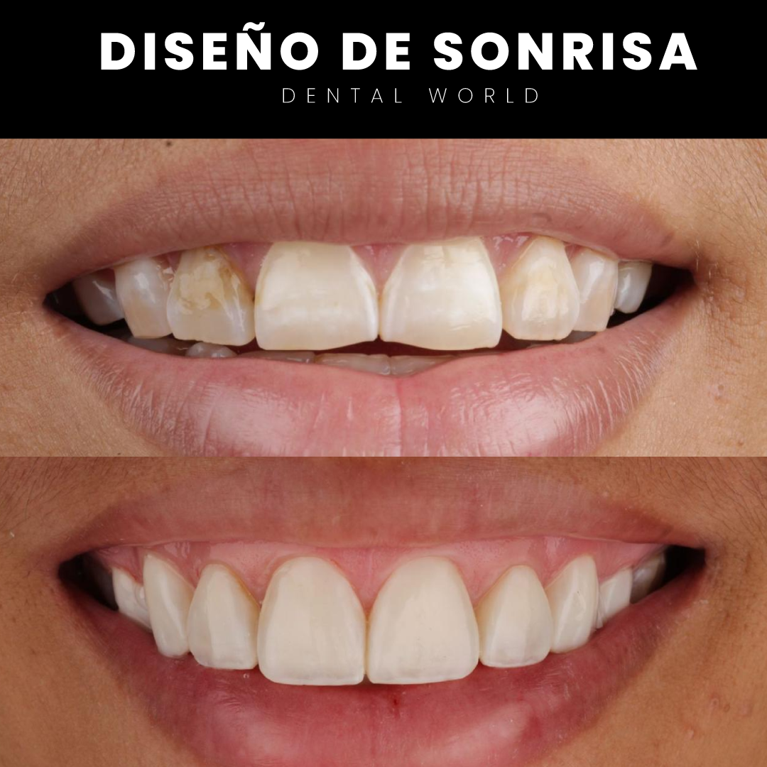 OTROS-SERVICIOS2