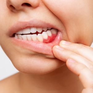 El impacto de la periodoncia en la salud general: una mirada desde Cartagena
