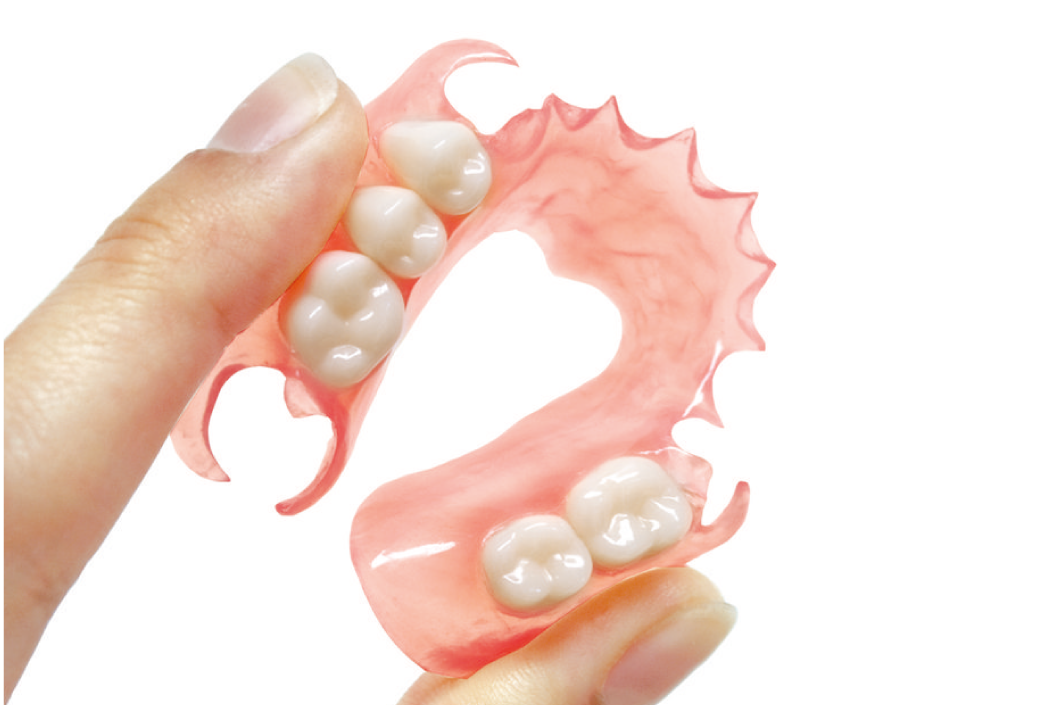 Prótesis Flexibles: Comodidad y Estética para Recuperar tu Sonrisa