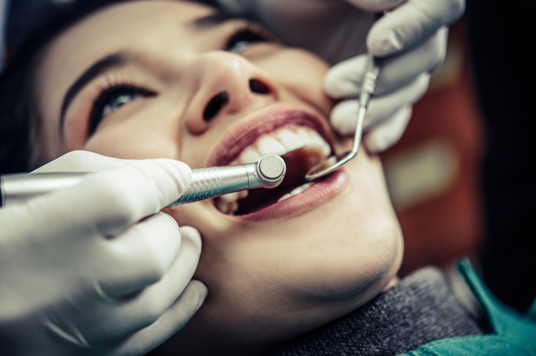 Los mitos del diseño de sonrisa: lo que debes saber antes de transformar tu sonrisa