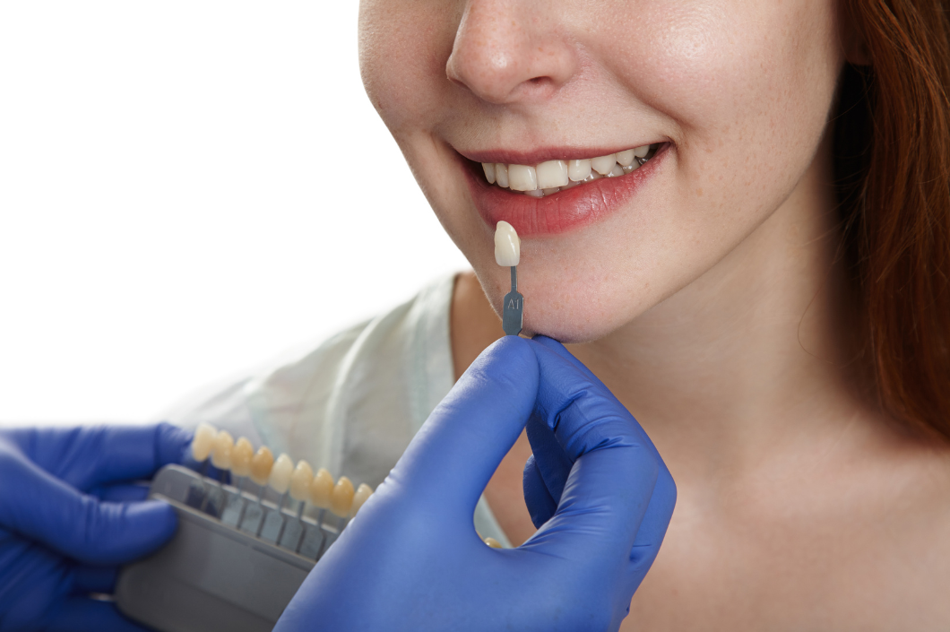 Sonrisas más blancas, bocas más sanas: Todo sobre el blanqueamiento dental y la salud oral