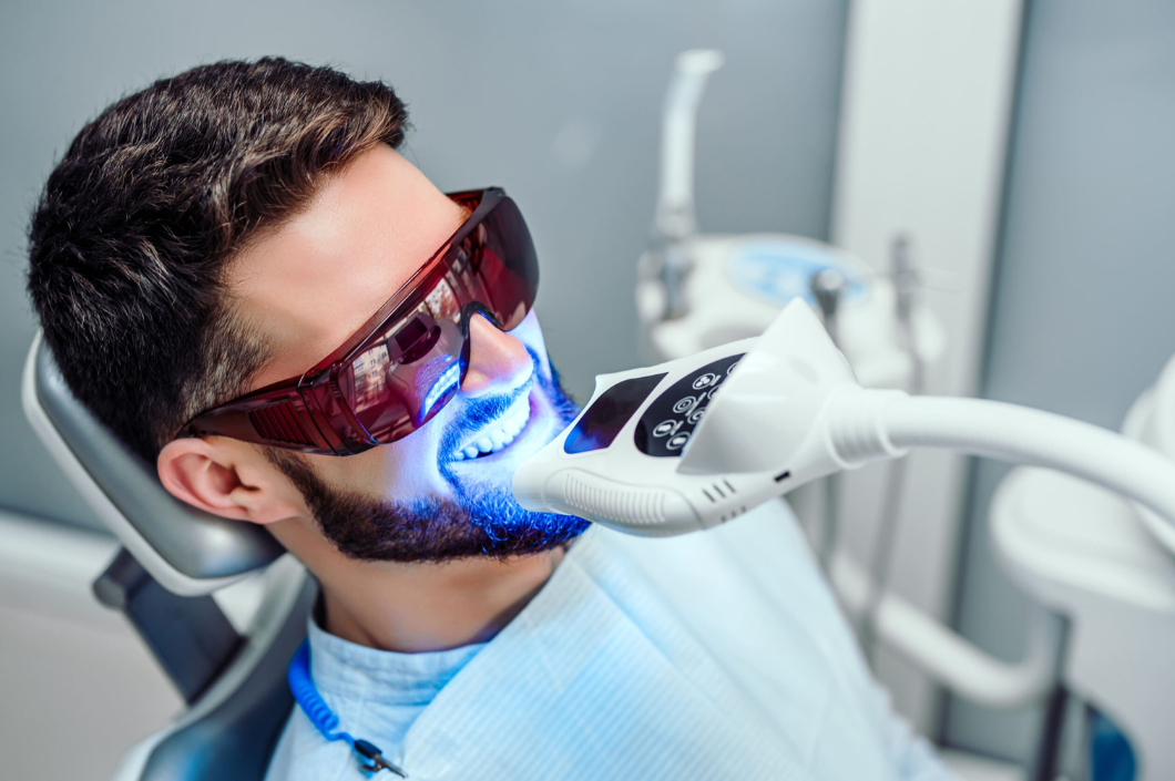Blanqueamiento Dental en Cartagena: Recupera el brillo de tu Sonrisa