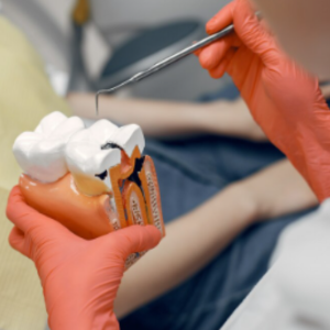 ¿Una endodoncia puede fallar? Causas y soluciones