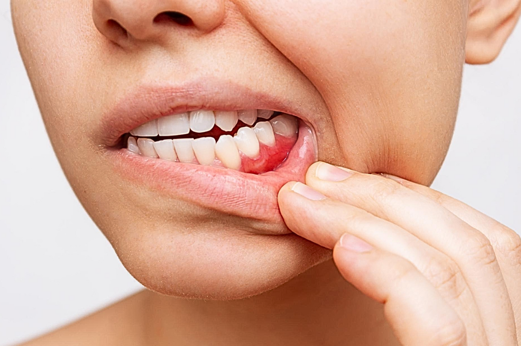 El impacto de la periodoncia en la salud general: una mirada desde Cartagena