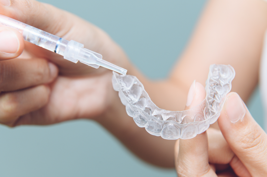 Blanqueamiento dental casero con férulas o blanqueamiento combinado: la fórmula perfecta para una sonrisa más blanca